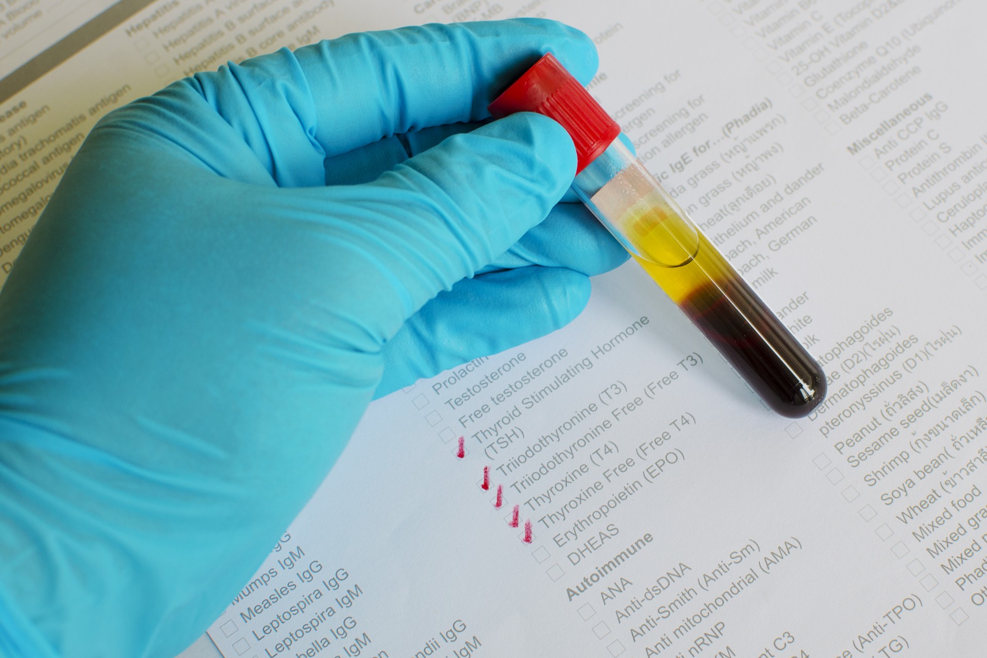 Thyroid function test