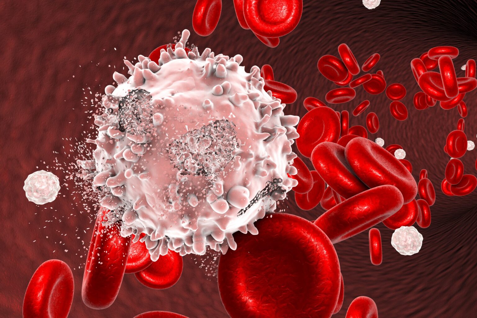 Childhood leukaemia: the importance of dirt, bugs and playmates 669bb10a88615.jpeg