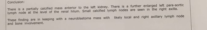 neuroblastoma