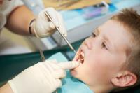 Increase in dental fluoride varnish treatments for children despite insufficient safety data 669bcfcdce7c3.jpeg