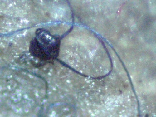 Morgellons/GMO link makes it into the news again 669bd60247ad3.jpeg