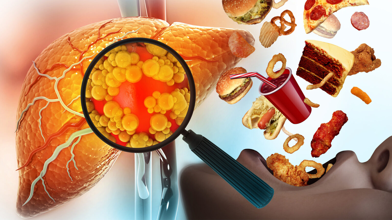 The hidden cost of convenience: how modern food is fuelling a silent liver epidemic 686e604487155.jpeg