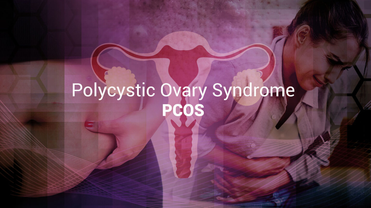 PCOS beyond reproduction: the metabolic roots of an hormonal disorder 696ea70043d5f.jpeg