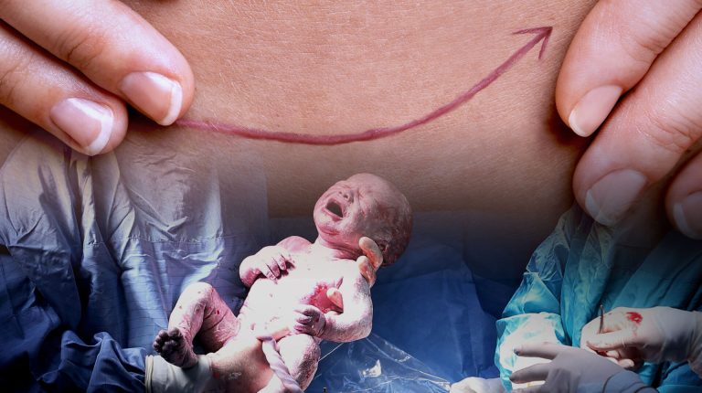 Birth on the clock: the hidden costs of the caesarean surge_68a301b05c01e.jpeg