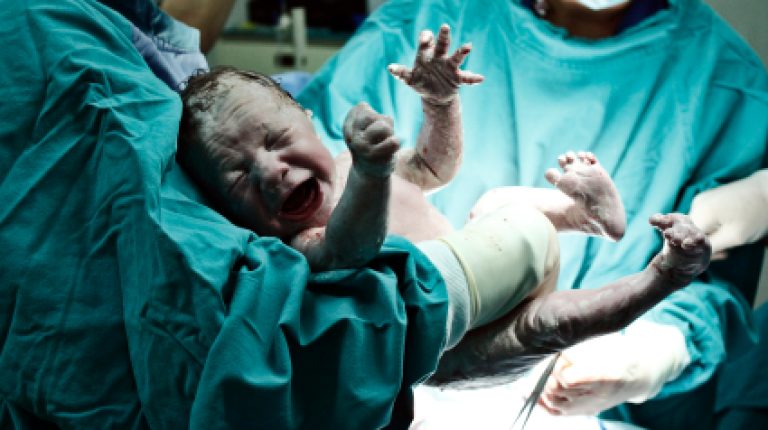 Caesarean sections to be ‘on demand’ in UK_669bd382a674f.jpeg