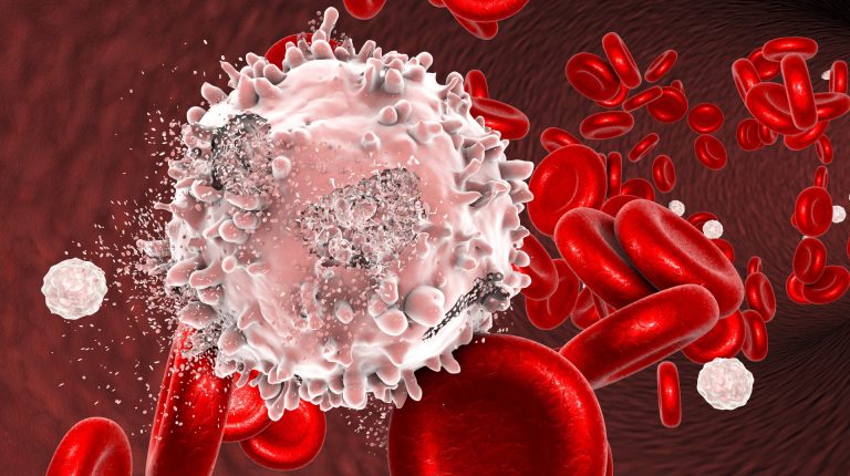 Childhood leukaemia: the importance of dirt, bugs and playmates_669bb10a88615.jpeg