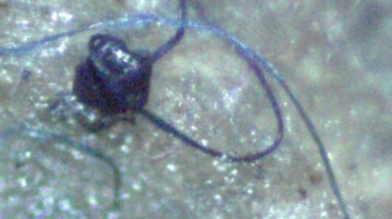Morgellons/GMO link makes it into the news again_669bd60247ad3.jpeg