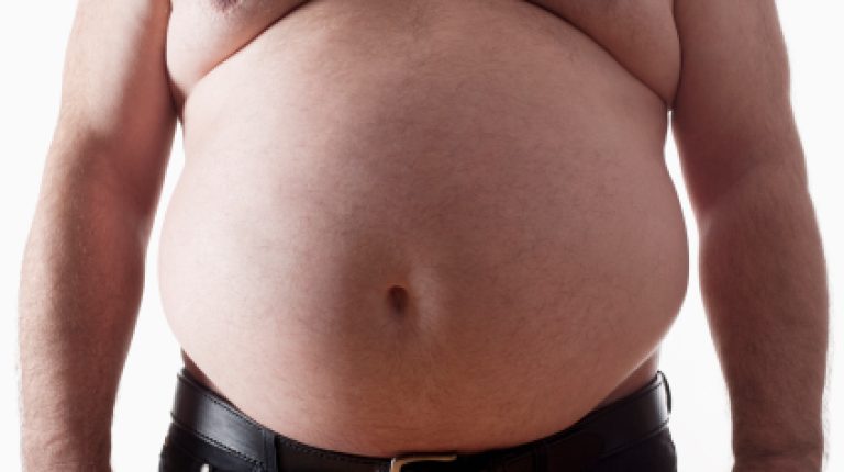 The UK government’s obesity strategy is a catalogue of incompetence – at best_669bc52341a87.jpeg