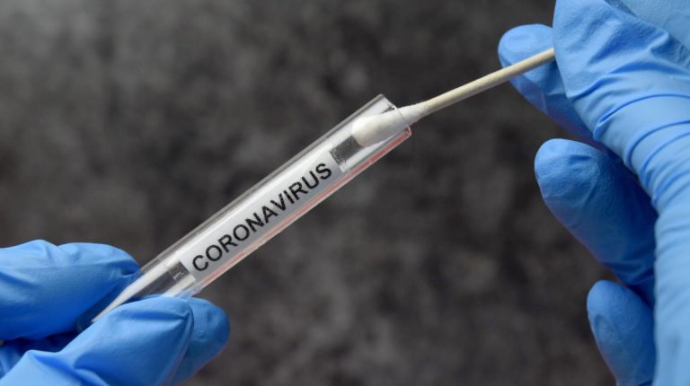 The Wild West of coronavirus testing_669b8539dc43d.jpeg